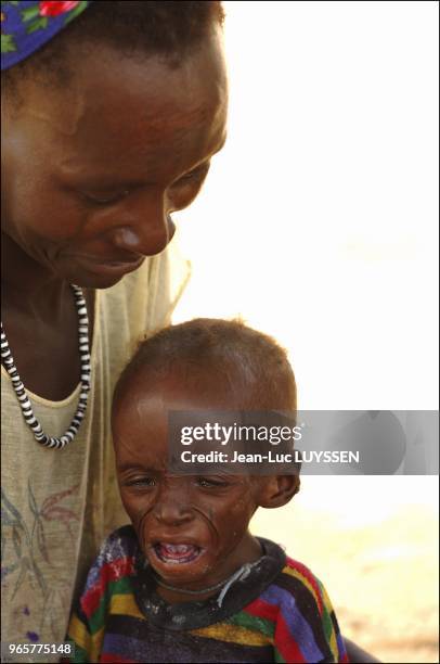 In a CRENI of the MSF in Zinder. The CRENI are centres for severely malnourished children.