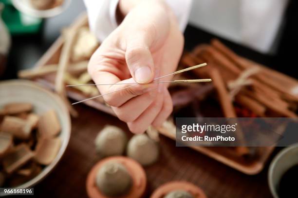 close up of doctor holding acupuncture needles - angelica hale stock pictures, royalty-free photos & images
