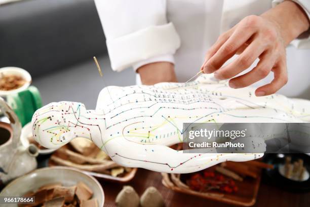 acupuncturist applying needles on acupuncture model - anatomista fotografías e imágenes de stock