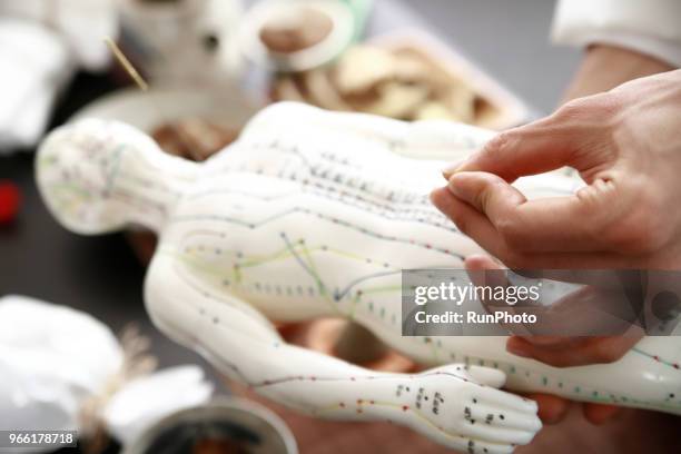 close up of doctor applying needles on acupuncture model - accupunctuurpop stockfoto's en -beelden