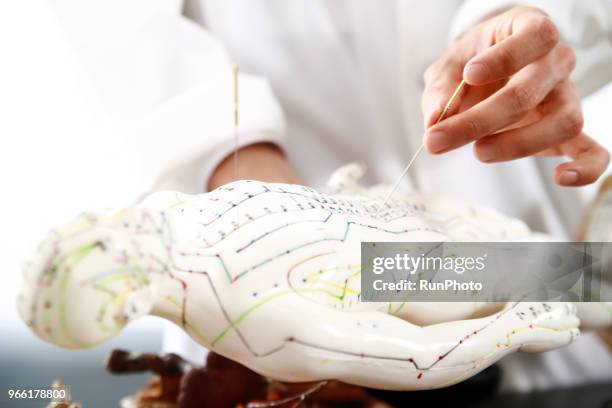close up of acupuncturist applying needles on acupuncture model - accupunctuurpop stockfoto's en -beelden