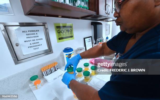 Medical assistant Barbara Dupree of the AIDS Healthcare Foundation Wellness Center closes bottles of patient's urine submitted for testing in...