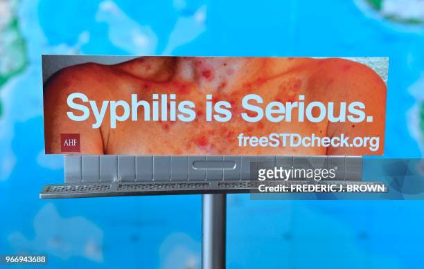 Model of a billboard from the AIDS Healthcare Foundation which ran in Los Angeles earlier this year but has been rejected to be displayed in many...