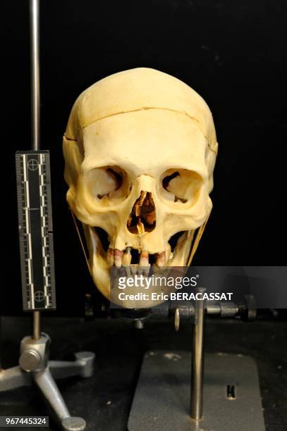 Laboratoire d'anthropologie, crâne et ossements humain en cours d'identification à l'Institut de Recherche Criminelle de la Gendarmerie Nationale ,...