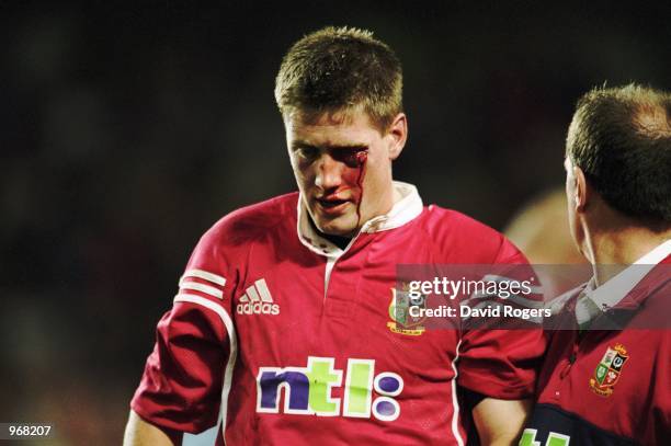 Ronan O''Gara of the British Lions leaves the field bleeding after an assault by Duncan McRae of the Waratahs during the Lions Tour to Australia...