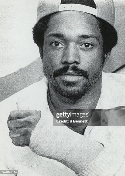 Ron LeFlore of the Montreal Expos holds up his left hand after an X-ray taken reveals a fractured bone in his left wrist on September 14, 1980 in...