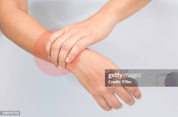 woman arm pain - touching elbows stock pictures, royalty-free photos & images