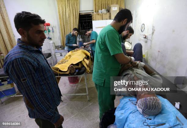 Graphic content / Wounded Syrians receive medical care in a hospital in Zardana, in the mostly rebel-held northern Syrian Idlib province, following...