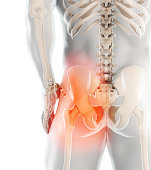 Hip painful skeleton x-ray, 3D illustration.