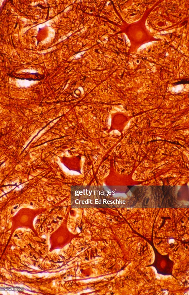 GRAY MATTER (Spinal Cord) with many MULTIPOLAR MOTOR NEURONS and unmyelinated nerve fibers, 50X