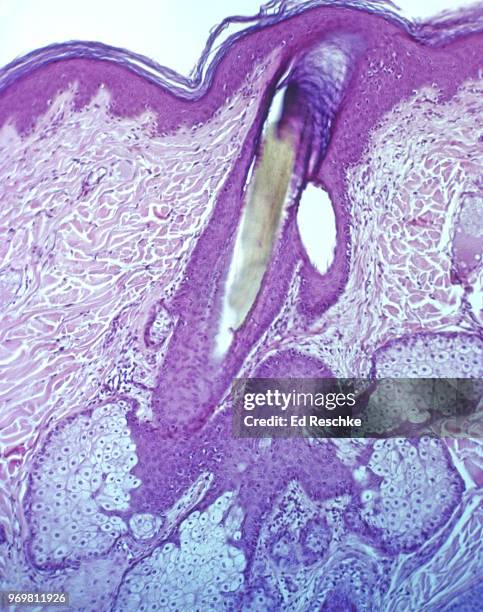 microscopic anatomy of the skin (scalp) hair follicle and sebaceous glands 25x - sebaceous gland stock pictures, royalty-free photos & images