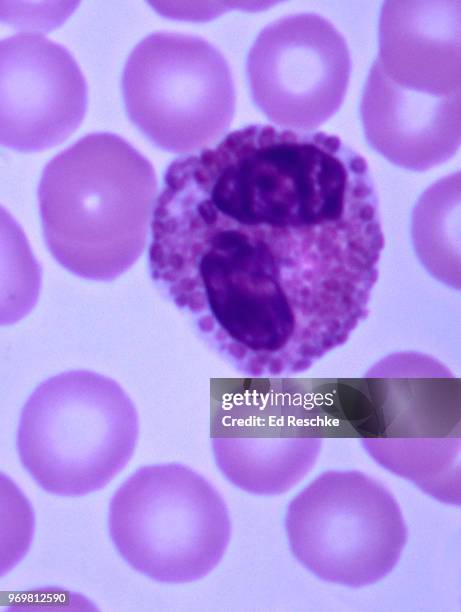 white blood cell (or leukocyte)--eosinophil, human blood smear, 400x - eosinófilo imagens e fotografias de stock