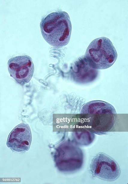 vorticella--a stalked, ciliated protozoan, 100x - vorticella imagens e fotografias de stock