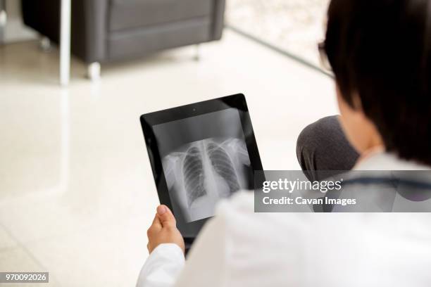 rear view of doctors looking x-ray report in tablet computer - human rib cage stock pictures, royalty-free photos & images