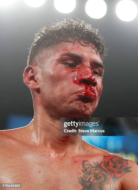 Antonio Moran bleeds from a cut on his nose as he walks to his corner at the end of the sixth round of his lightweight bout against Jose Pedraza at...