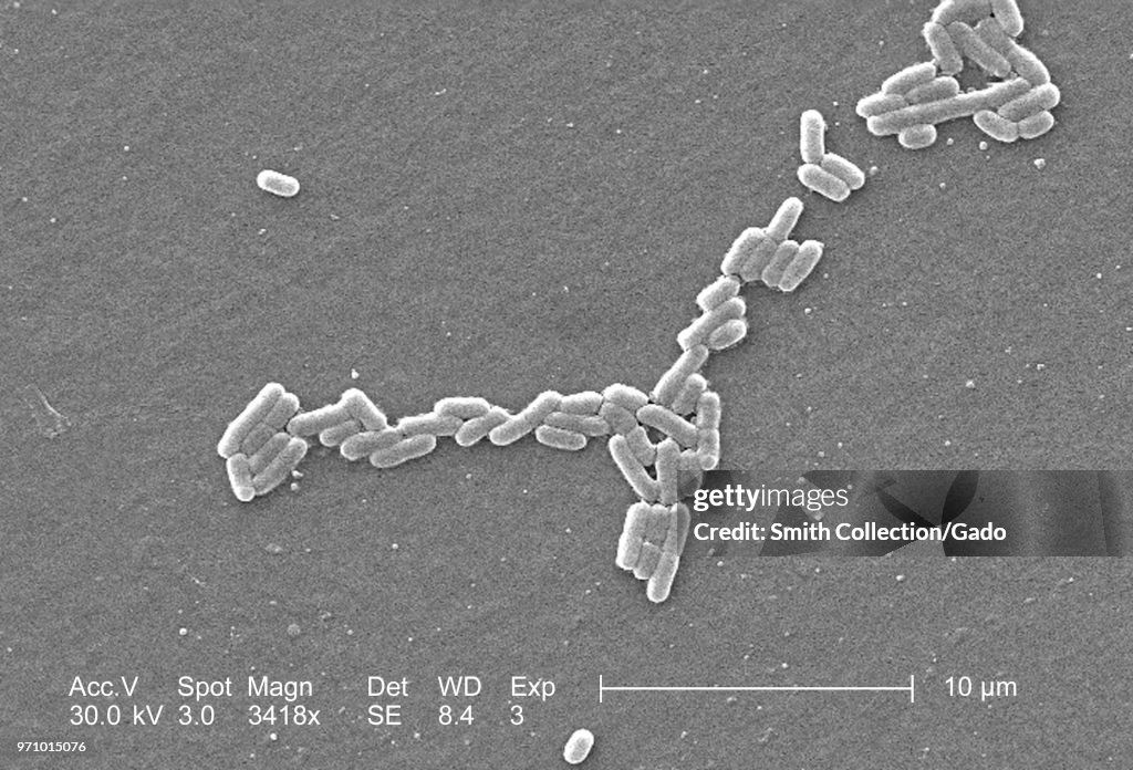 Escherichia Coli