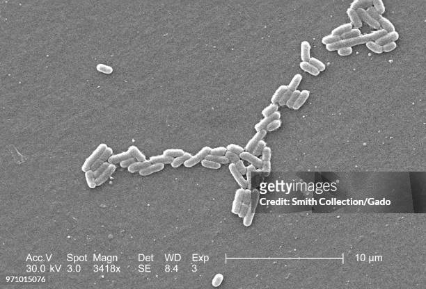 Gram-negative Escherichia coli bacteria of the strain O157:H7, revealed in the 3418x magnified scanning electron microscopic image, 2006. Image...