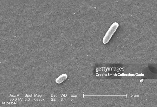 Gram-negative Escherichia coli bacteria of the strain O157:H7, revealed in the 6836x magnified scanning electron microscopic image, 2006. Image...