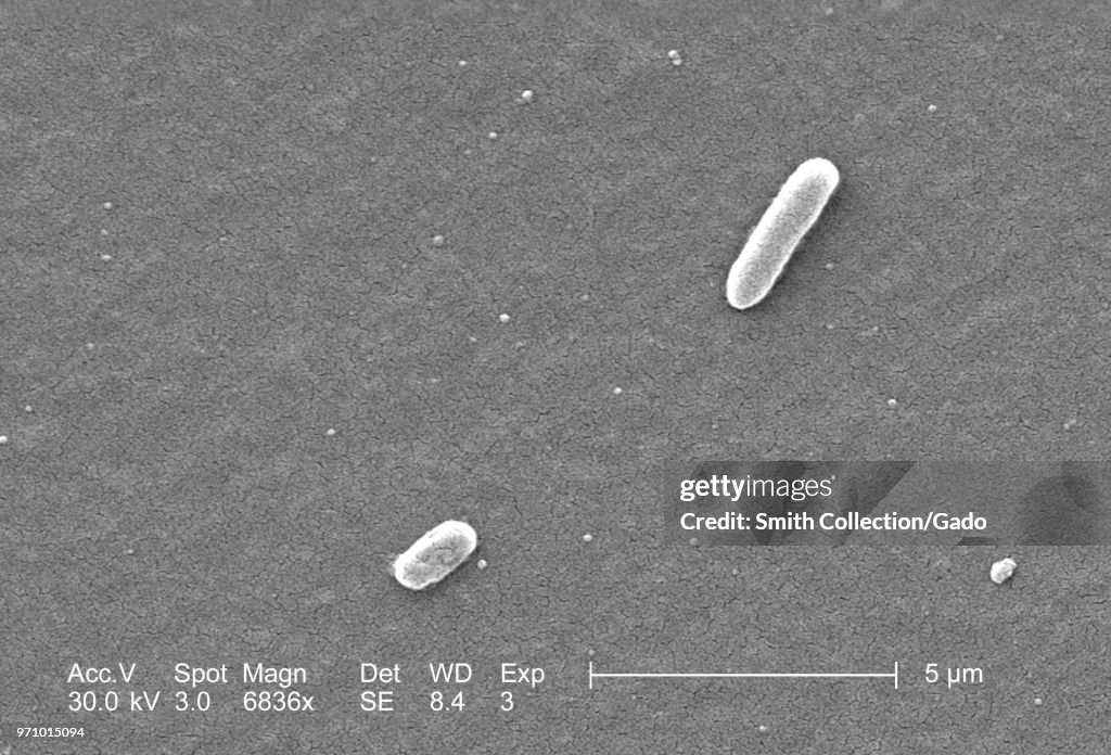 Escherichia Coli