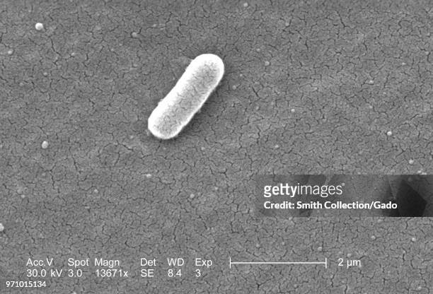 Gram-negative Escherichia coli bacteria of the strain O157:H7, revealed in the 13671x magnified scanning electron microscopic image, 2006. Image...