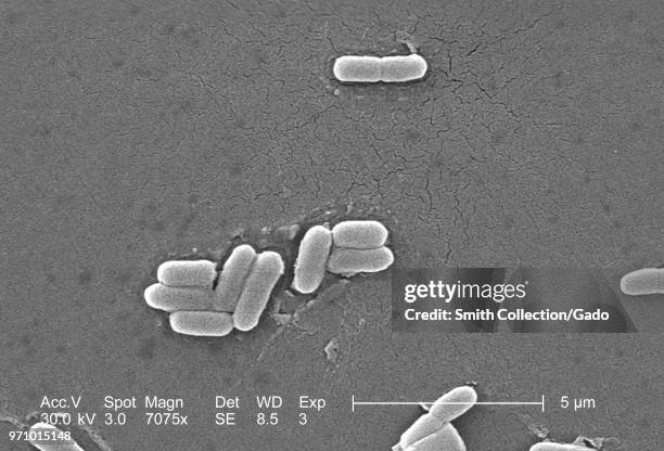 Gram-negative Escherichia coli bacteria of the strain O157:H7, revealed in the 7075x magnified scanning electron microscopic image, 2006. Image...