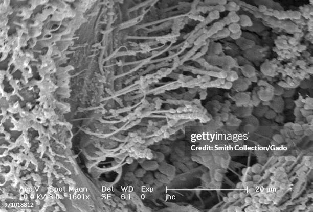 Morphologic features on the exoskeletal surface of an Anopheles gambiae mosquito, revealed in the 1601x magnified scanning electron microscopic...