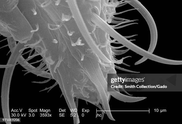 Morphologic features displayed on the distal tip of an Anopheles gambiae mosquito's "labellum", revealed in the 3593x magnified scanning electron...