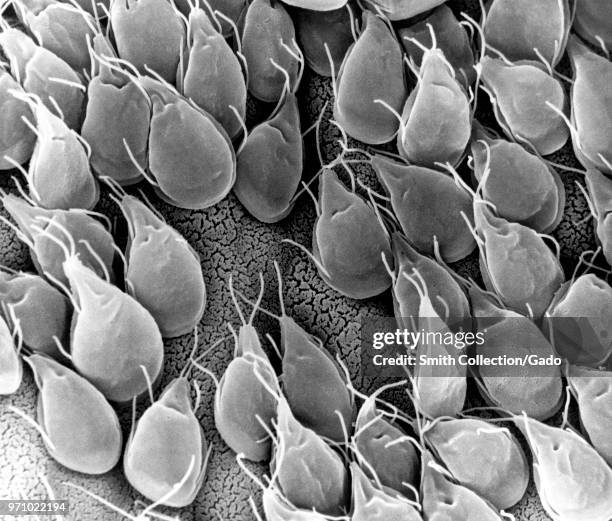Mucosal surface of the small intestine of a gerbil infested with Giardia, 1988. Image courtesy Centers for Disease Control / Dr Stan Erlandsen.