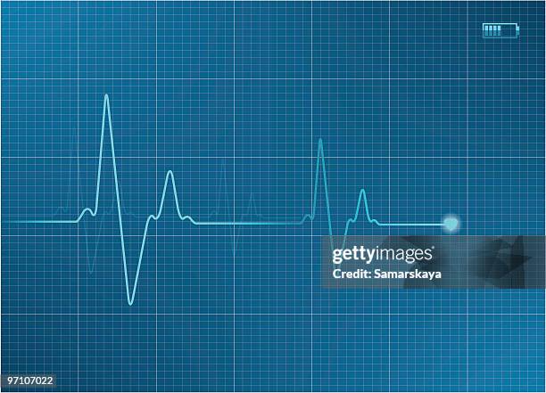 stockillustraties, clipart, cartoons en iconen met electrocardiogram - heartbeat