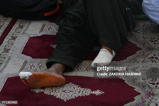 This picture taken on June 8, 2018 shows the bandaged feet of an Afghan peace activist as he rests on a carpet during a march from Helmand to Kabul...
