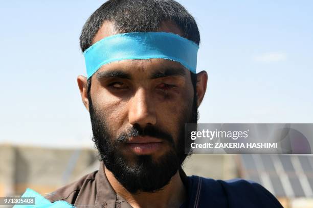 This picture taken on June 8, 2018 shows Afghan peace activists, Zaheer Ahmad Zindani, blinded in a roadside explosion, wearing a headband during a...