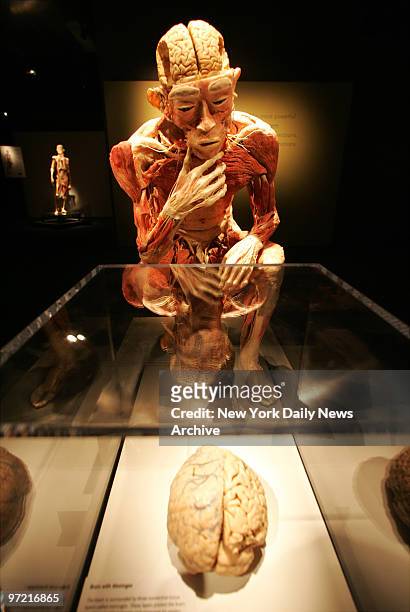 Preserved cadaver in a crouching position appears to be considering a human brain at "Bodies...The Exhibition," which opened today in the new...