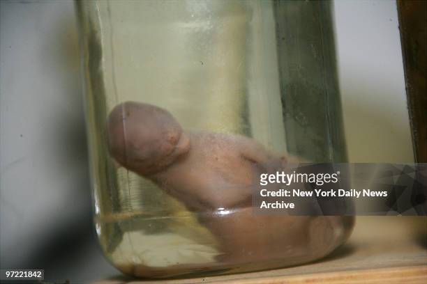 Four-inch-long fetus preserved in formaldehyde was among the ghoulish items, including skulls and sulfuric acid, discovered yesterday in a makeshift...