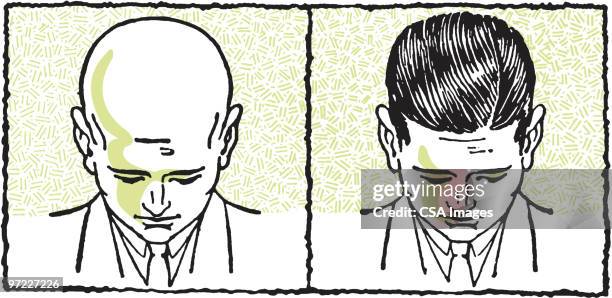 illustrazioni stock, clip art, cartoni animati e icone di tendenza di before-and-after of bald man growing hair - bald man