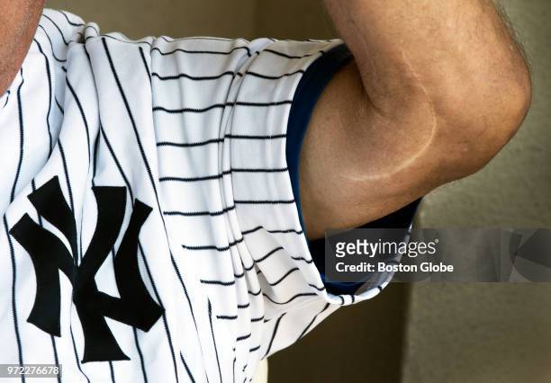 Tommy John, the 4 time All Star Major League Baseball pitcher who won 288 games, shows the famous scar on his elbow in La Quinta, CA on April 28,...