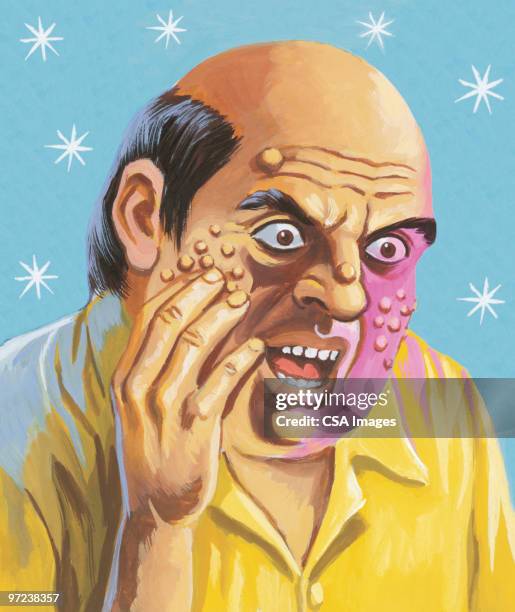 man with boils on his face - ugly bald man stock illustrations