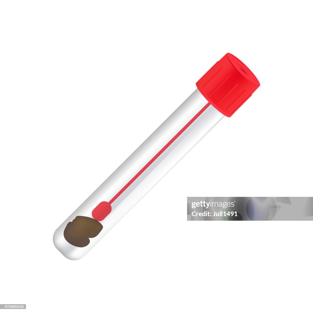 Medical A Stool Sample In A Glass Test Tube On White Background High ...