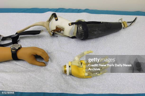The i-Limb, a bionic hand with motors to power each finger, is on display along with more traditional prostheses at Hanger Prosthetics & Orthotics....