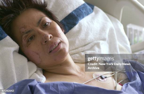 Vasana Mututanont rests in her bed in the burn unit of New York Weill Cornell Medical Center. Mututanont, a mother of three and director of the...