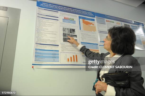 Dr Cheryl Greenberg, a Canadian genetic researcher, points at X-rays of people afflicted with the genetic disorder hypophosphatasia at a hospital in...