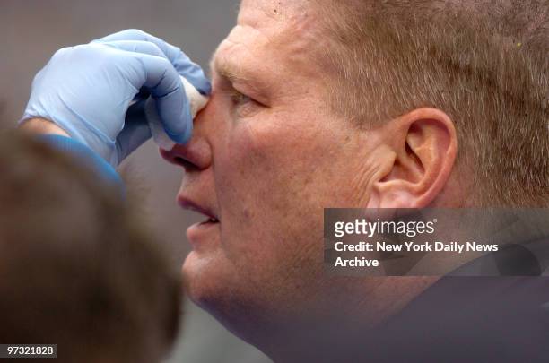 Umpire Bill Schuster has his nose treated after being accidentally hit during a run by New York Jets' Leon Washington in the third quarter of a game...