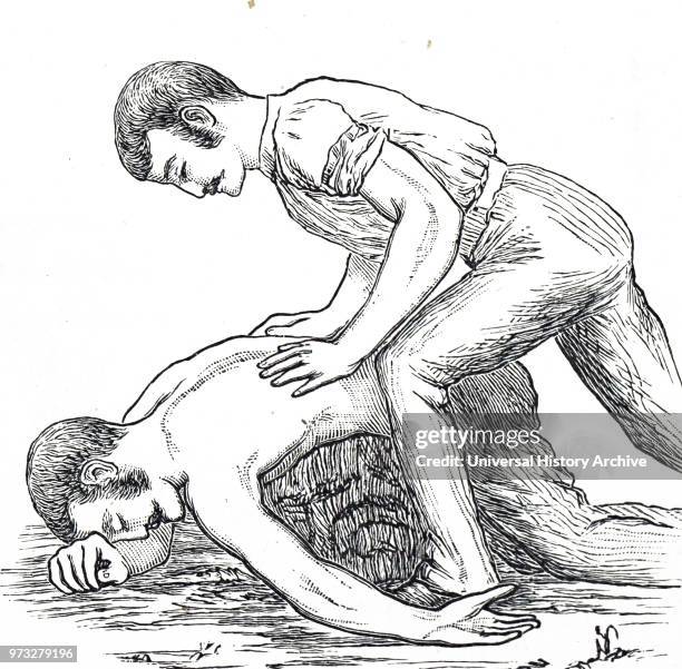 Engraving depicting a man trying to resuscitate a drowning victim by pressing on their back to drain water from the lungs and stomach. Dated 19th...