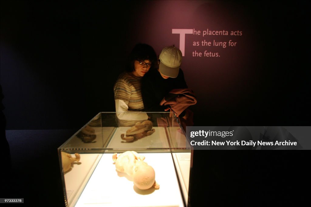 Visitors contemplate a preserved fetus on the opening day of