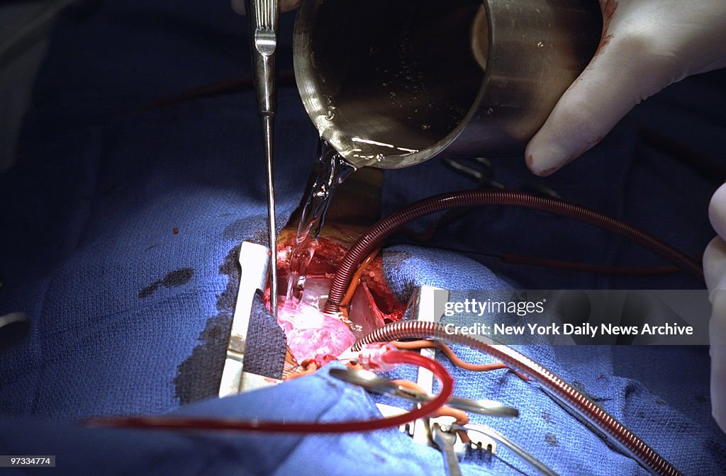 Open-heart surgery is performed on Merolyn Rosario at Columb