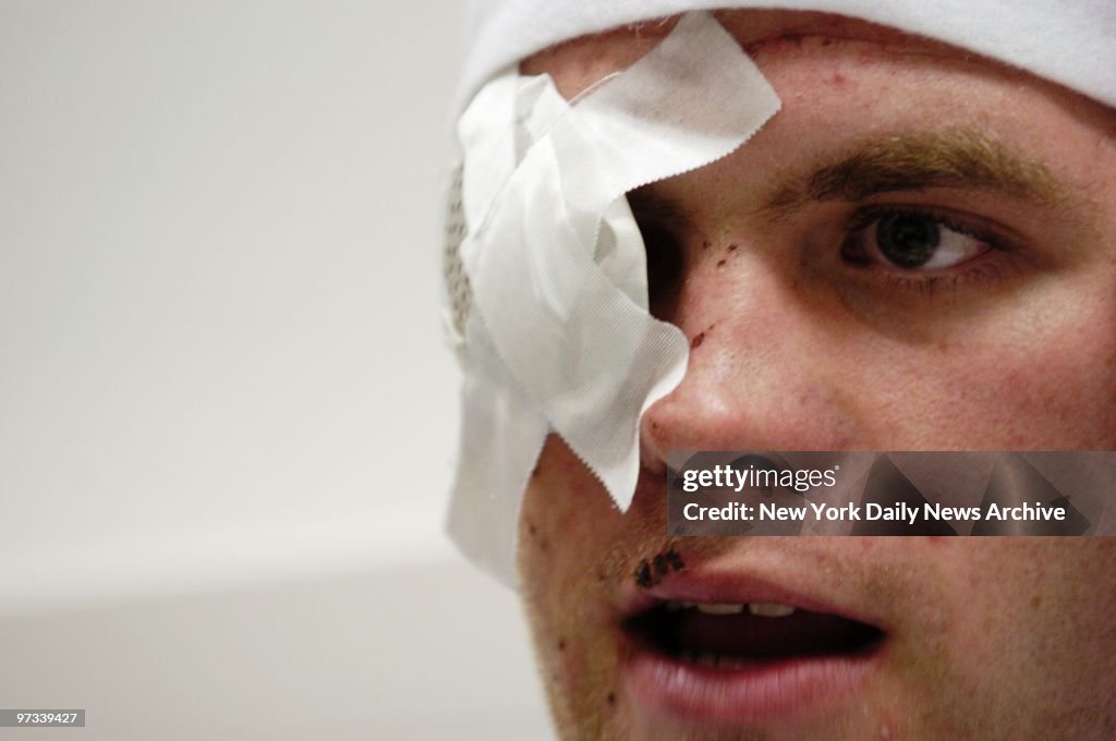 Bandage In Eye Eye Bandage Eye Area Hydrogel Bright Patch – Eye Mask | FREZYDERM