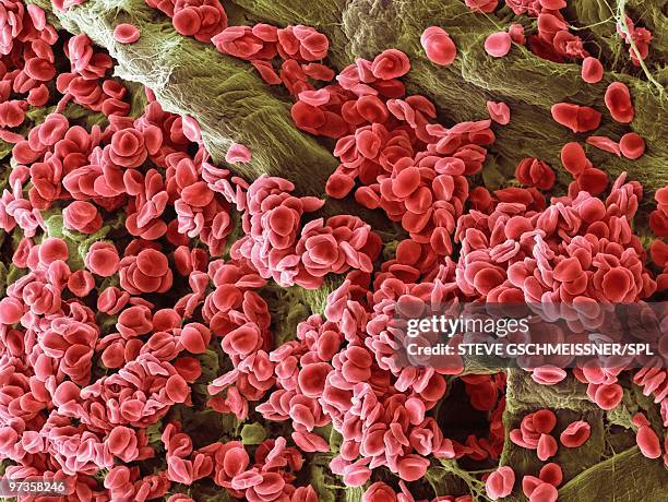 red blood cells, sem - scanning electron micrograph stock pictures, royalty-free photos & images
