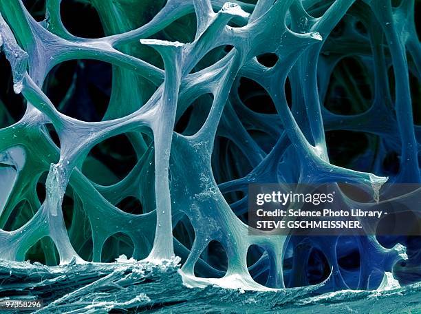 bone tissue, sem - micrografia elettronica a scansione foto e immagini stock