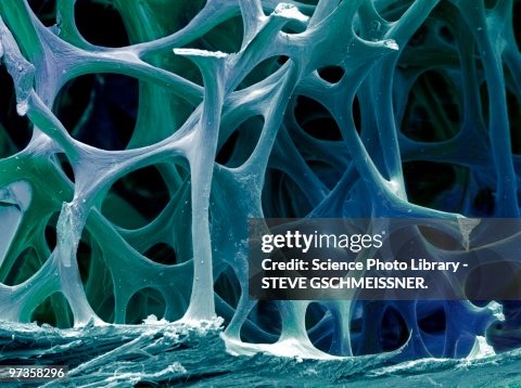 Bone tissue, SEM Bone tissue, SEM
