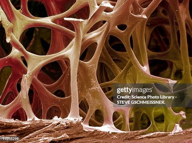 bone tissue, sem - vue au microscope électronique à balayage en réflexion photos et images de collection