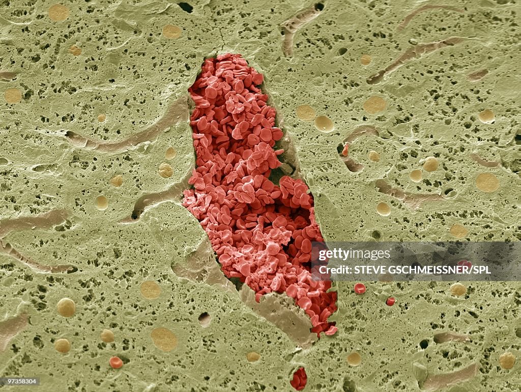 Liver vein, SEM